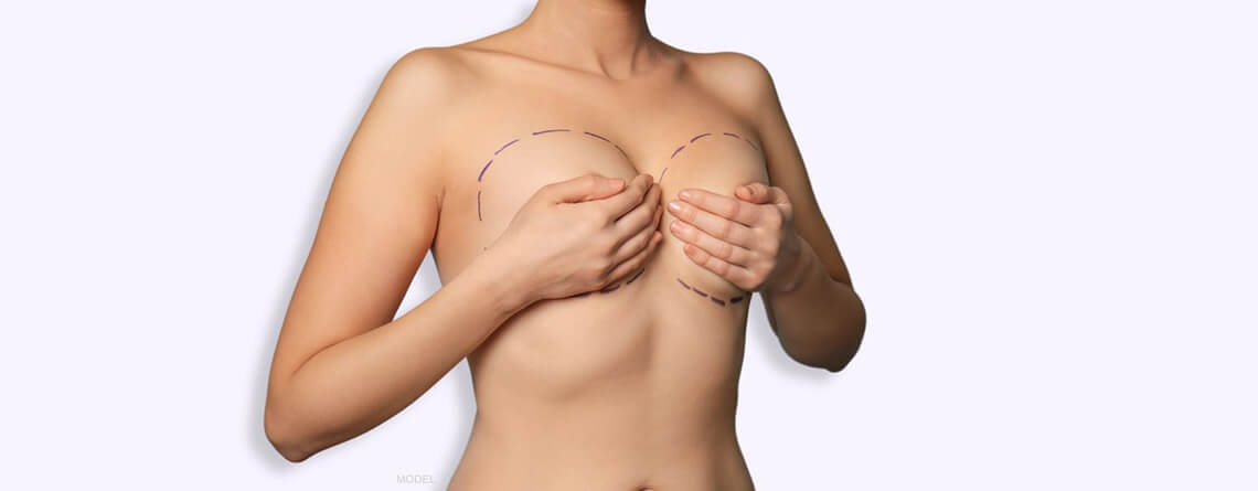 How Much is a Breast Lift?