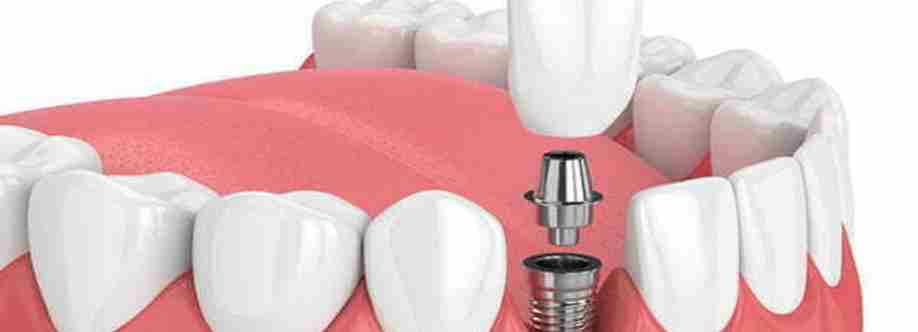 Benefits of Dental Implants Profile Picture