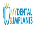 My Dental Implants profile picture