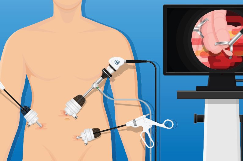 Best Laparoscopic Surgeon In Dubai | Laparoscopy Cost UAE