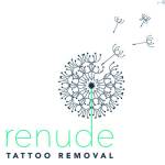 Renude Laser Tattoo Removal Profile Picture