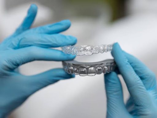 Invisalign vs. Traditional Braces: Why Reston Patients Prefer Clear Aligners - Free Guest Posting