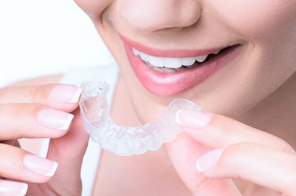 Invisible Braces in Borivali West - Roosh Dental Clinic