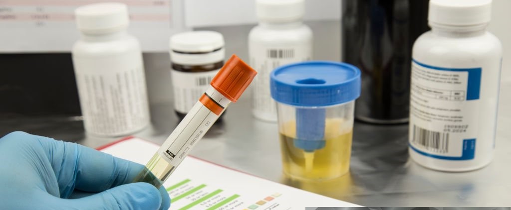 Alcohol and Drug Testing - All You Need To Know - Peace of Mind Drug Testing Services