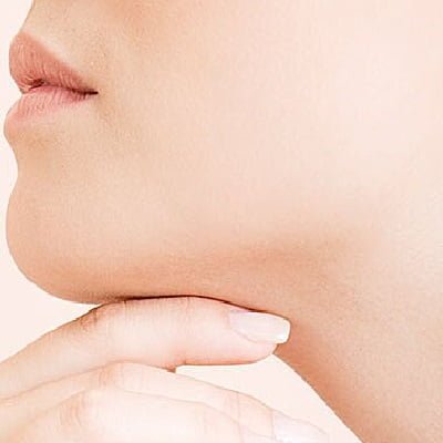 Double Chin Removal in Islamabad, Rawalpindi & Pakistan | Cost, Price