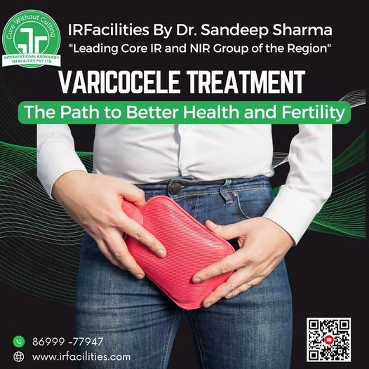 Prehensive Guide to Varicocele Treatment What You Need to Know – @irfacilities on Tumblr