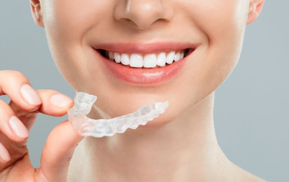 How Invisalign Works: Understanding the Treatment Process