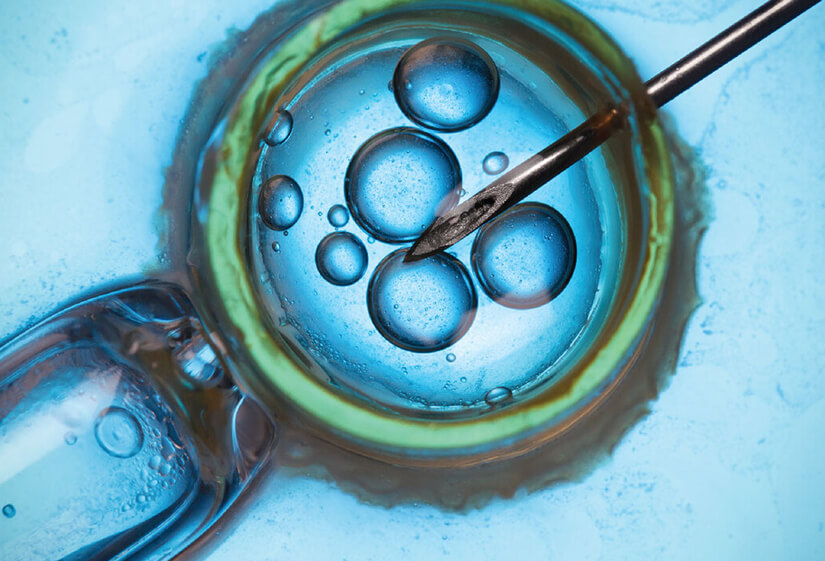 Where to Go for IVF Treatment in Delhi?