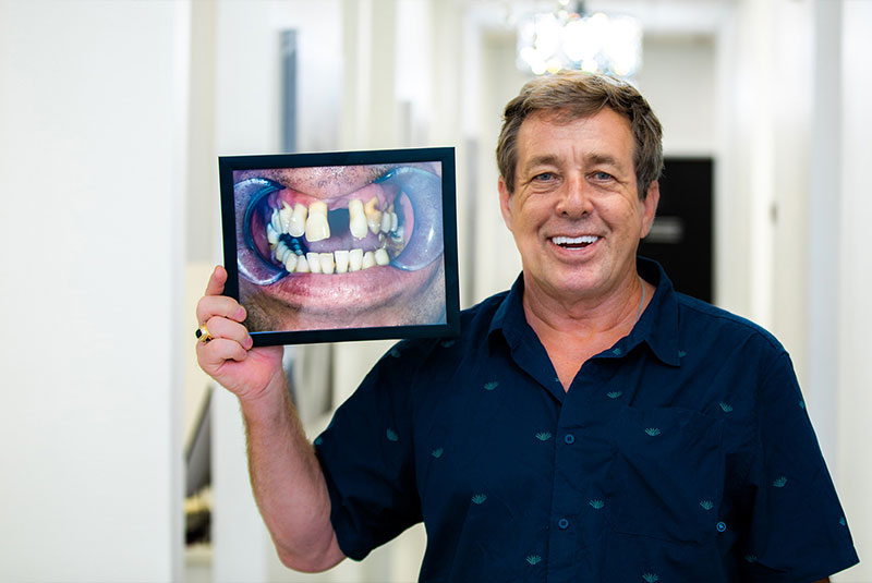 Top-Rated Implant Dentist in Seminole, FL | Dental Implant Center