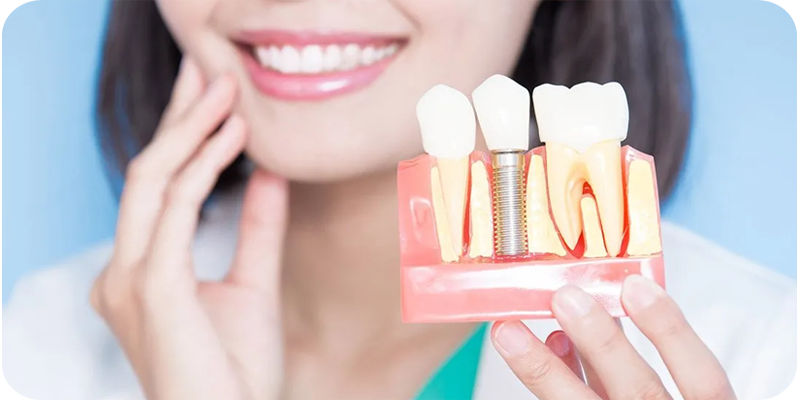 Best Dental Implants, Full Mouth Dental Implants & Denture Solutions for Seniors | The Smile Spa Dental Clinic