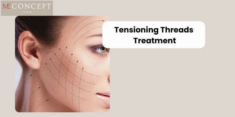 7 Key Benefits of Choosing Tensioning Threads Treatment For A Youthful Look | by Me Concept clinic | Nov, 2024 | Medium