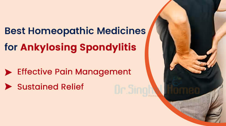 5 Best Homeopathic Remedies for Ankylosing Spondylitis