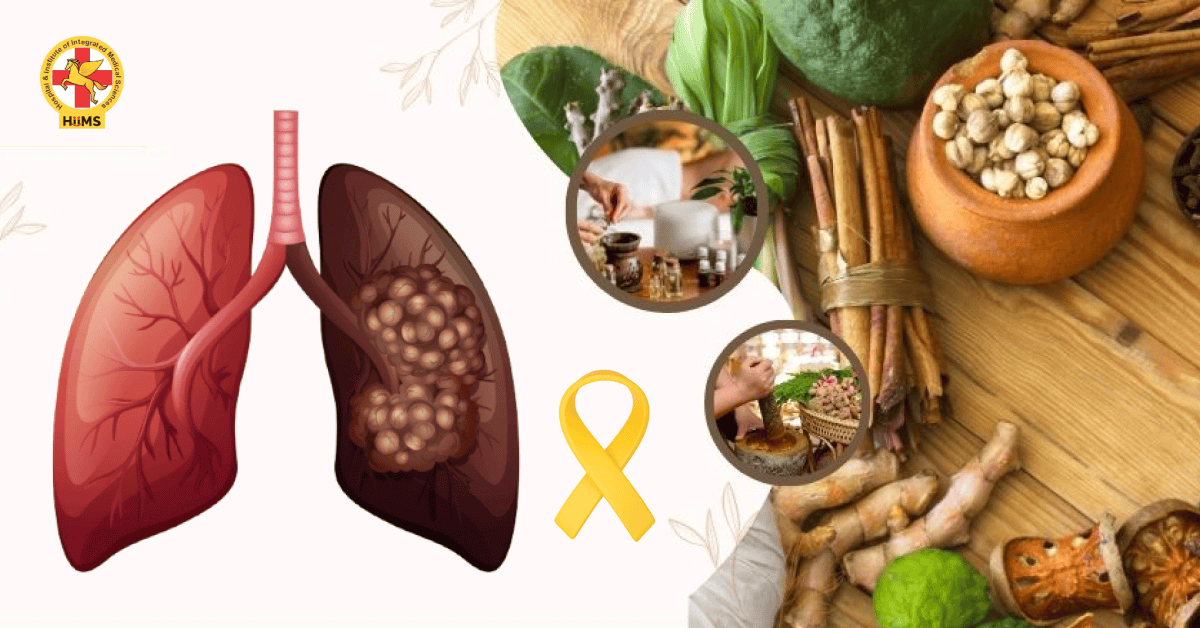 How Ayurveda Can Help Manage Lung Cancer Symptoms Naturally