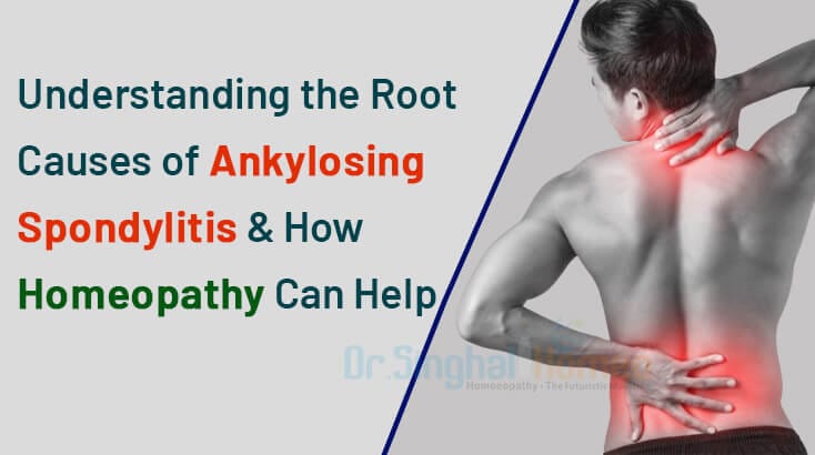 Understanding the Root Causes of Ankylosing Spondylitis