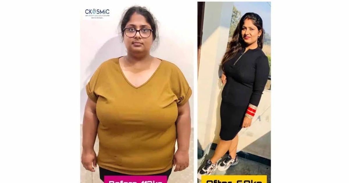 Patient Care at CKOSMIC Health City: A Holistic Approach to Weight Loss