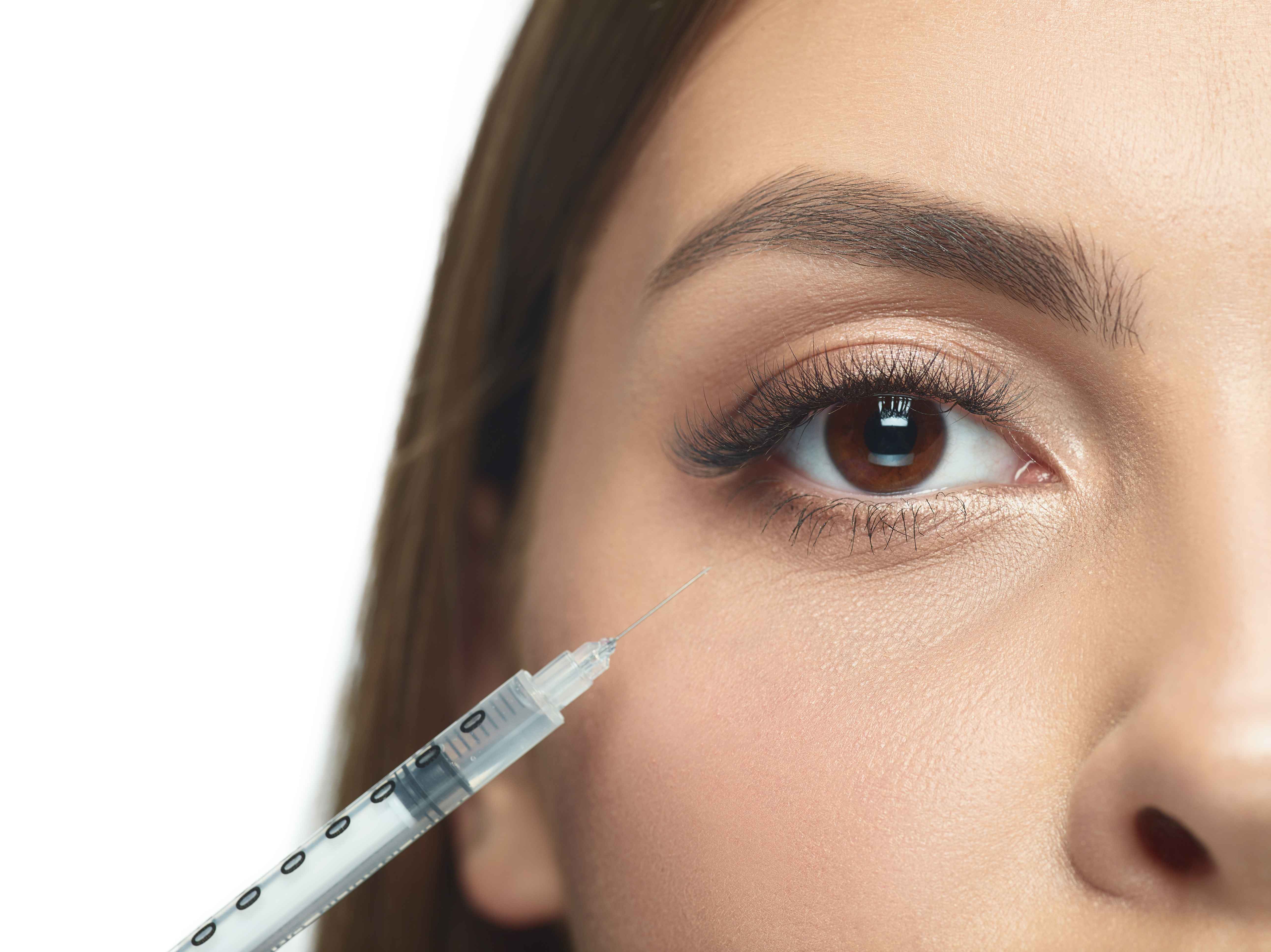 Transform Your Look With Under Eye Filler Treatment