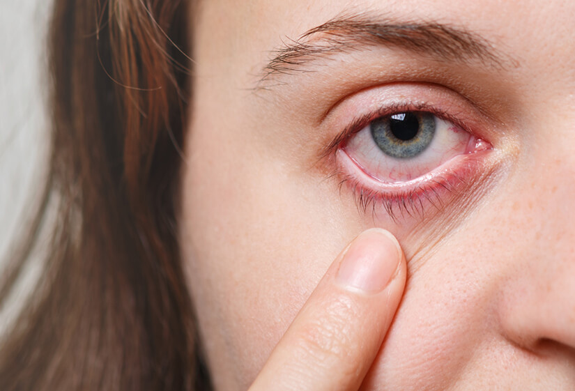 What is Diabetic Eye Disease?