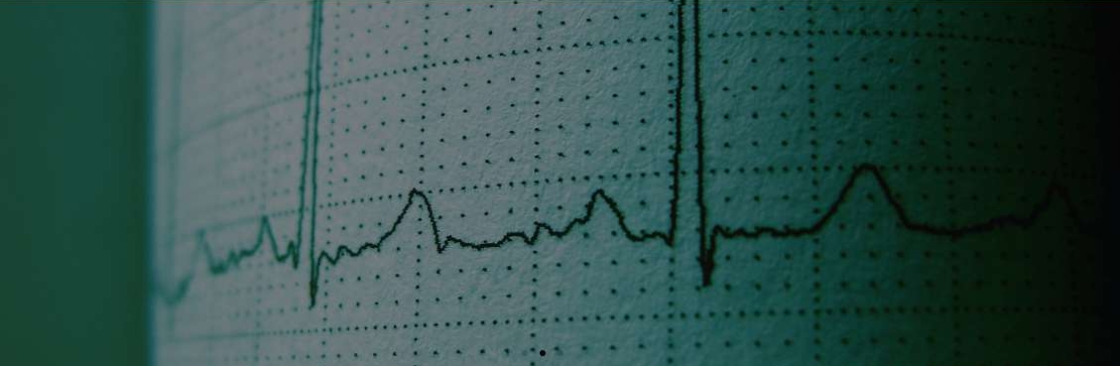 ECG Rhythm Experts Cover Image