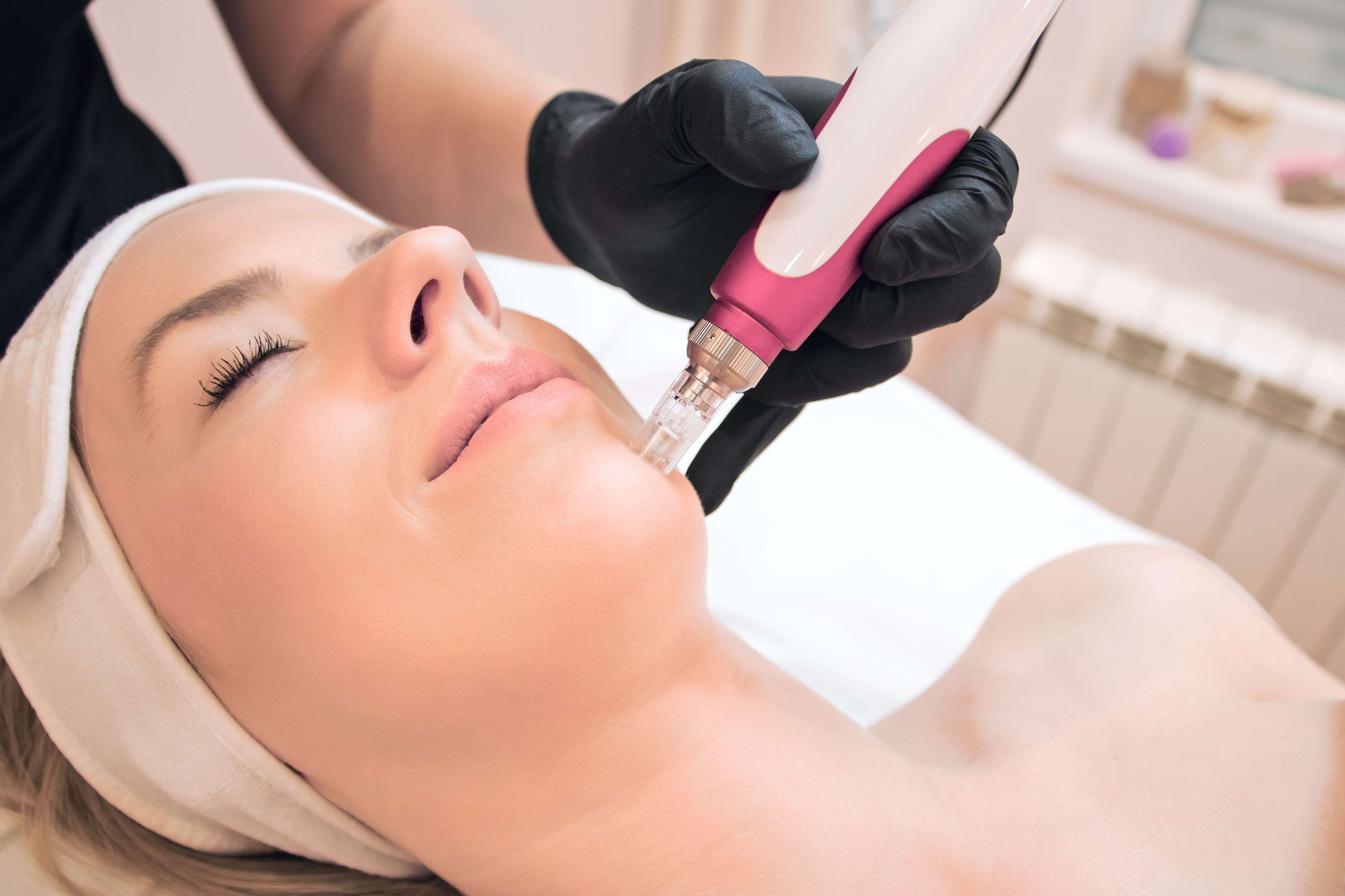 microneedling56 Profile Picture