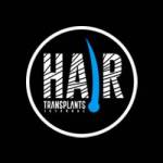 Hair Transplants Istanbul Profile Picture