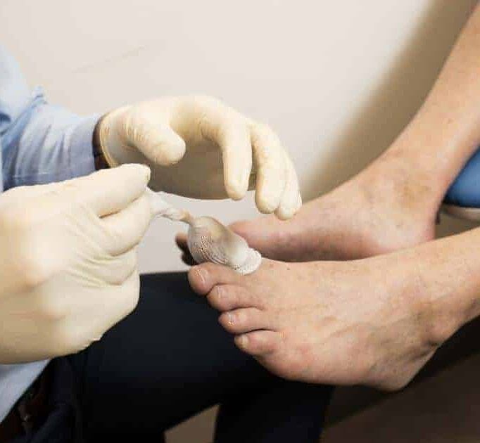 Everything You Need to Know About Ingrown Toenail Care