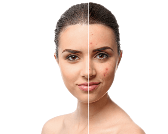 Dermatology Clinic in Abu Dhabi | Best Dermatologist | Botox