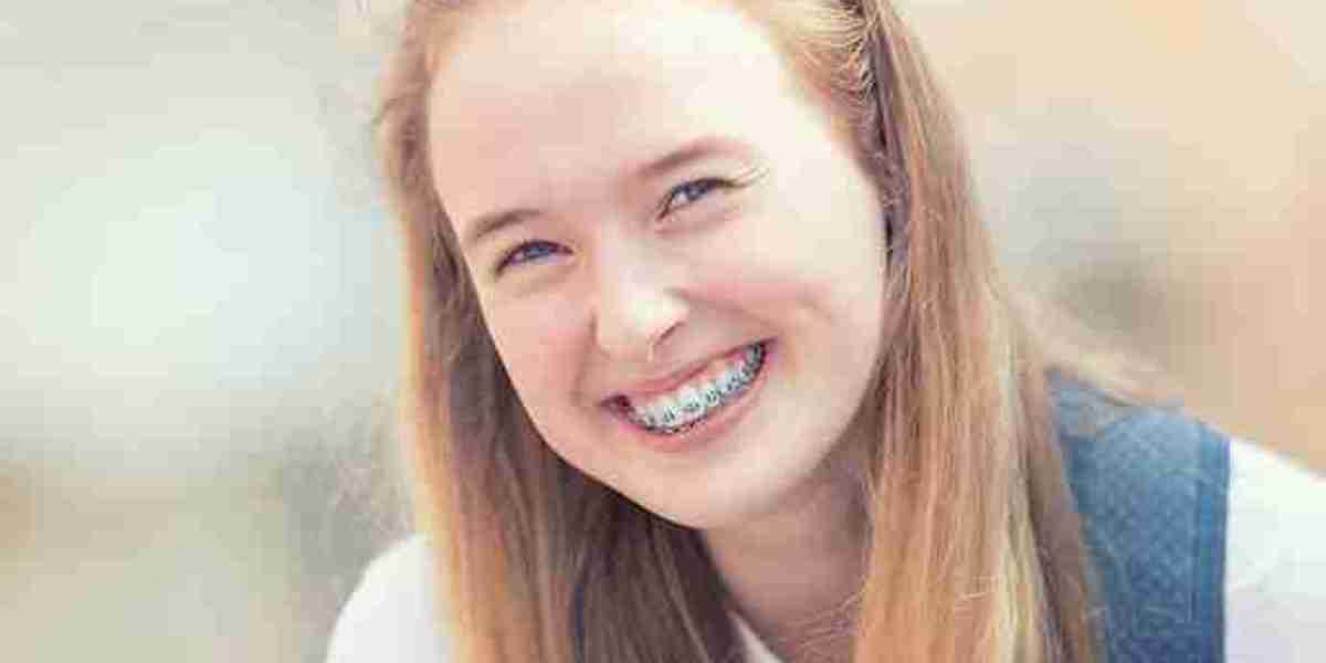 Do You Need a Dental Mouth Guard? Signs You Shouldn't Ignore