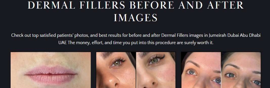 Fillers Dubai Cover Image