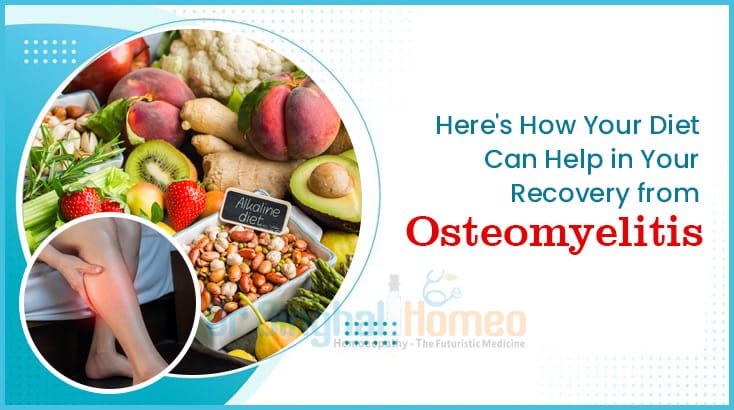 Foods to Consume to Combat Osteomyelitis for Better Health