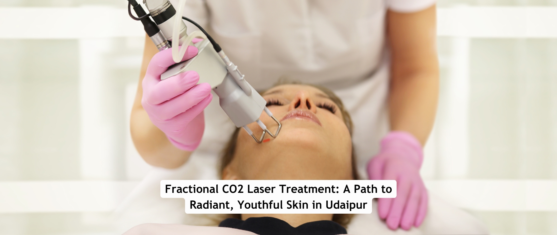 Fractional CO2 Laser Treatment: A Path to Radiant, Youthful Skin in Udaipur