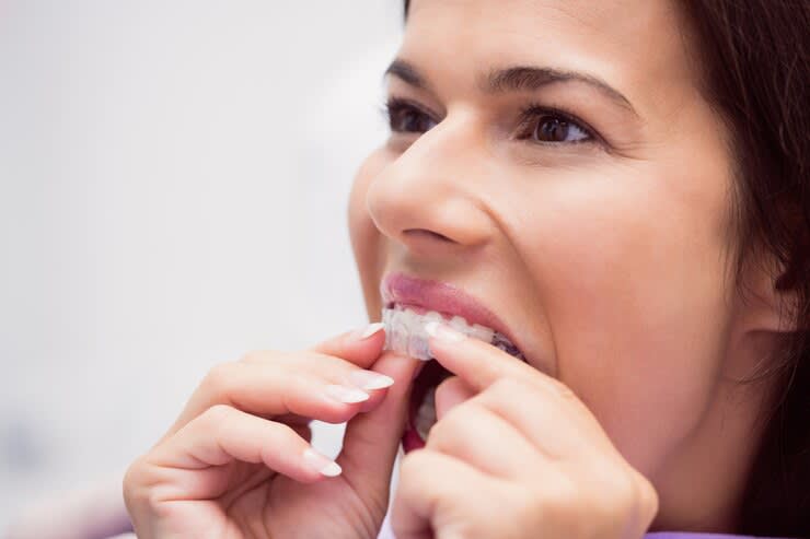 10 Effective Tips to Speed Up Invisalign Treatment | Longevity