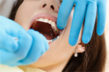 Comprehensive Gum Disease Treatment in Melbourne CBD