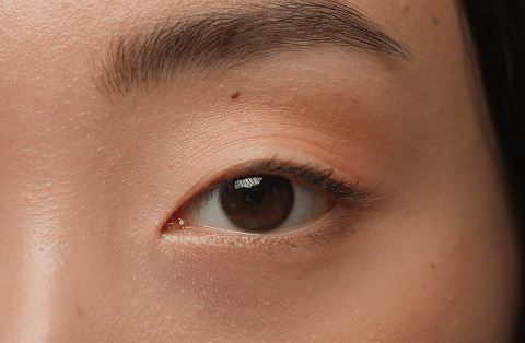 How to Remove Eye Bags Permanently? | Dr Sabrina™