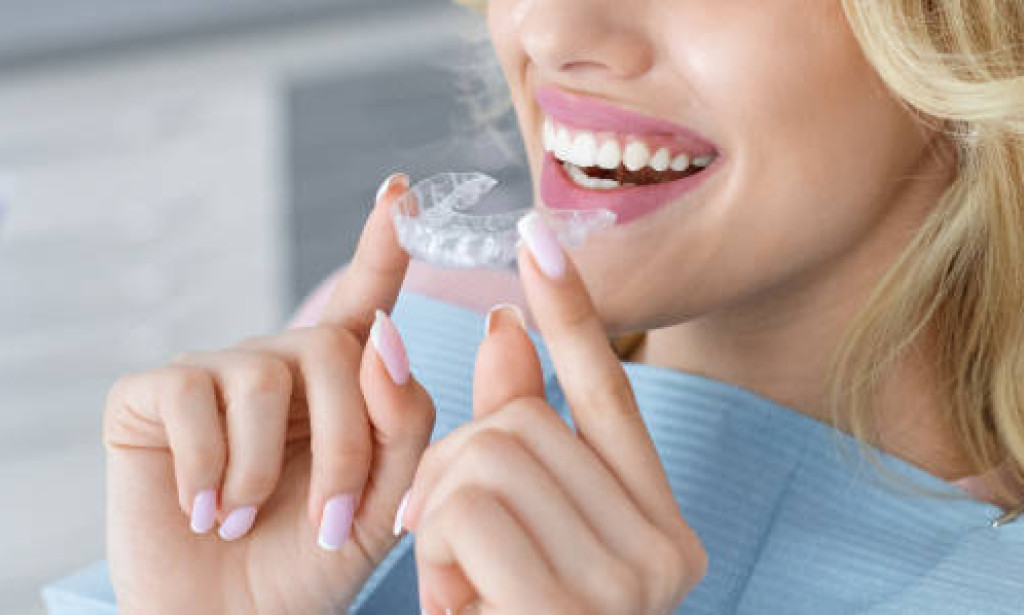 How Invisalign Transforms Your Smile in Record Time