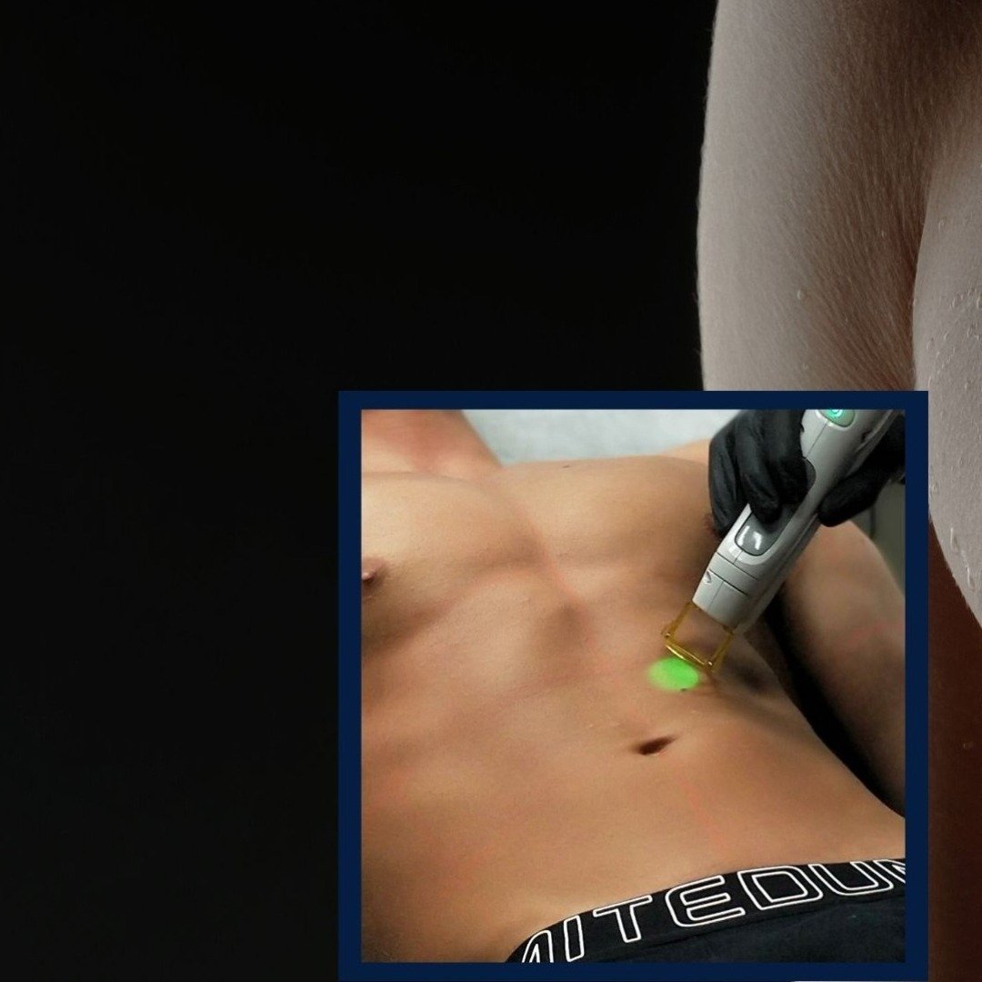 Feel Confident Every Day with Men's Laser Hair Removal in Regents Park - guest-post.org