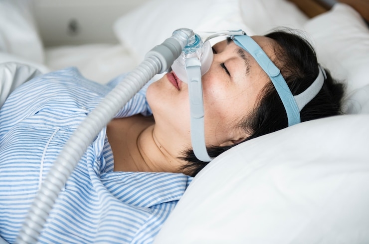 How Long Is Recovery From Sleep Apnea Treatment? | Bundas24