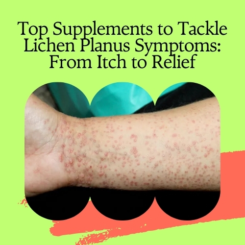 Top Supplements to Tackle Lichen Planus Symptoms: From Itch to Relief - Natural Health News