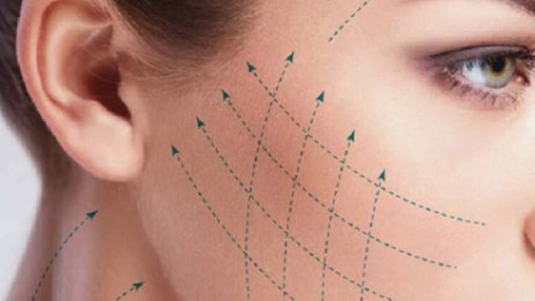 7 Key Benefits of Choosing Tensioning Threads Treatment For A Youthful Look | Websyndic