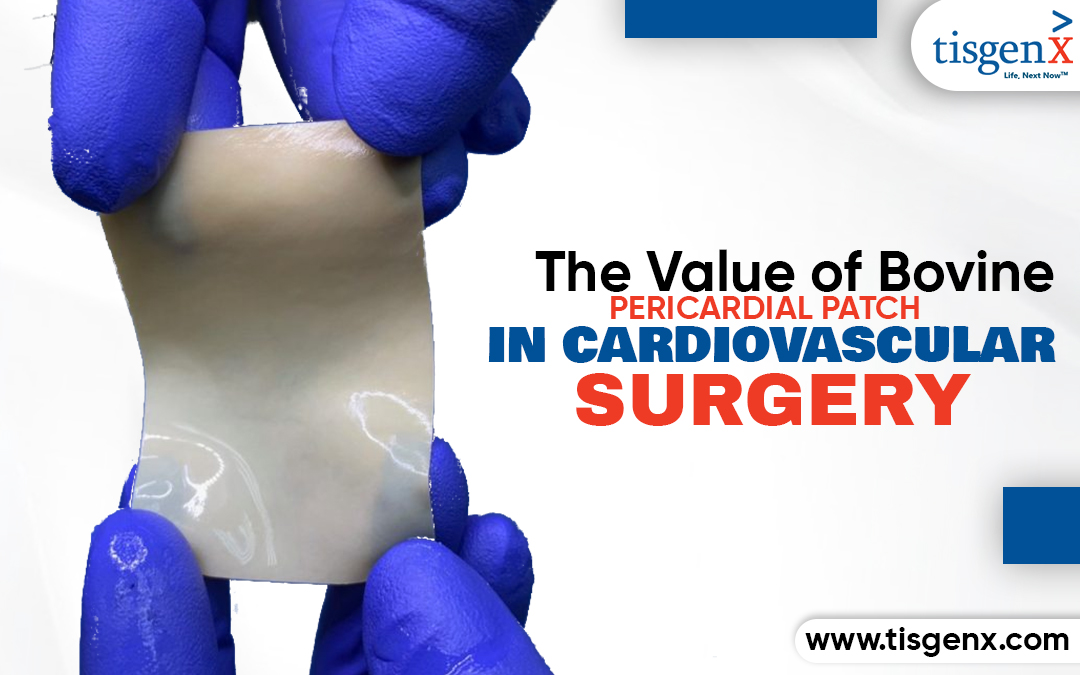 The Value of Bovine Pericardial Patch in Cardiovascular Surgery – Tisgenx, Inc