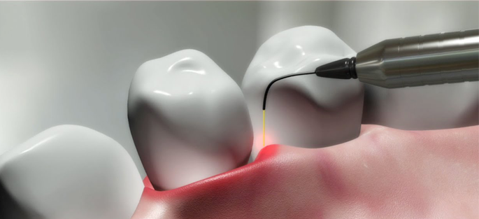 Painless Dental Treatment in Nagpur | Painless Dental Treatment Dhantoli