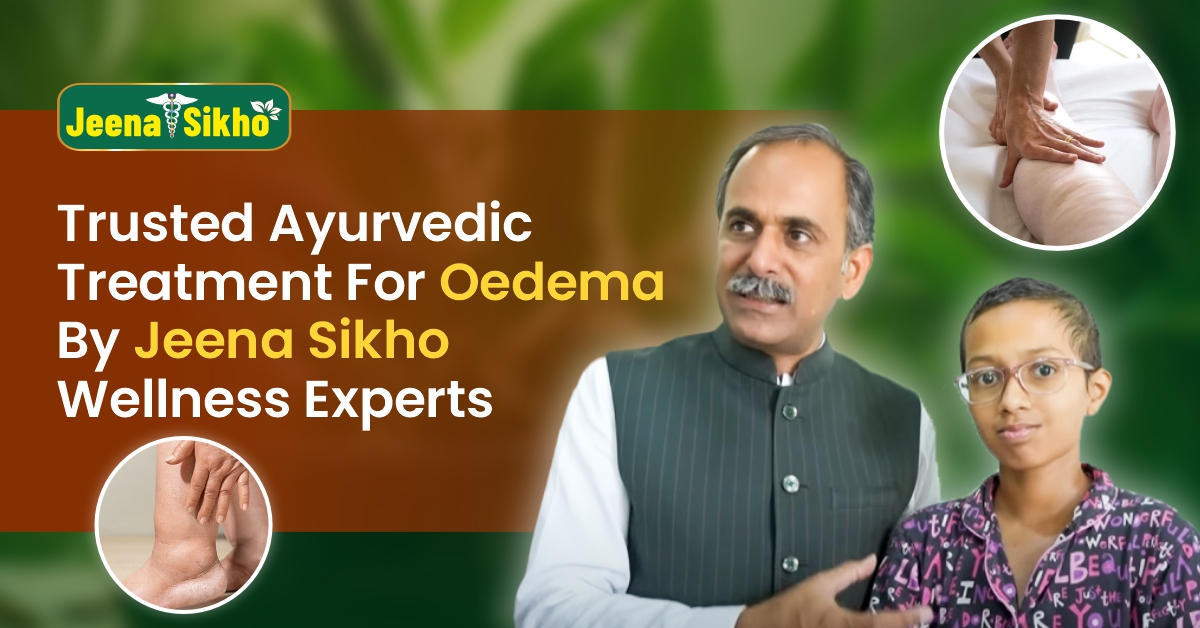 Trusted Ayurvedic Treatment for Oedema by Jeena Sikho Wellness Experts