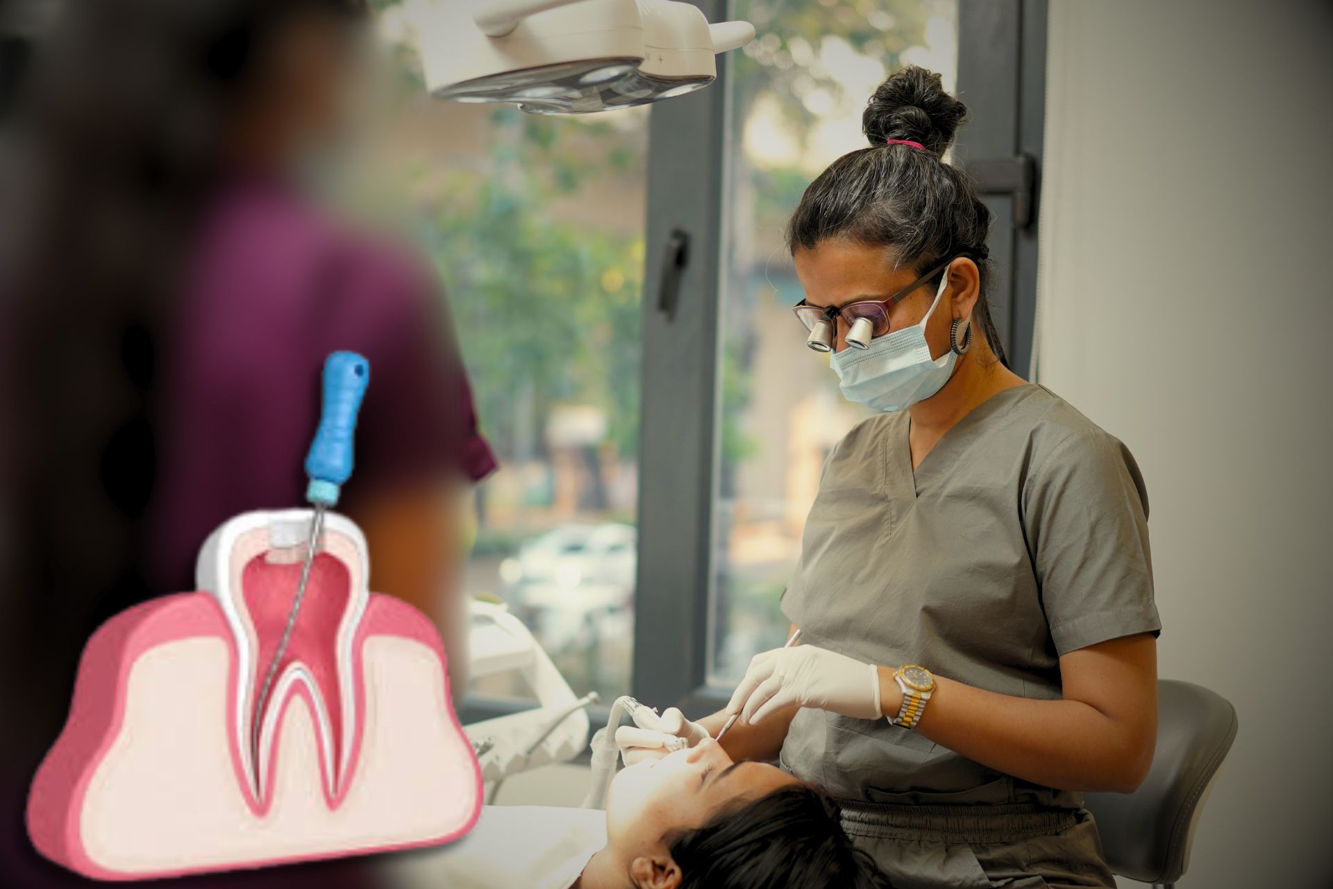 Root Canal Treatment in Nagpur | RCT Cost in Nagpur