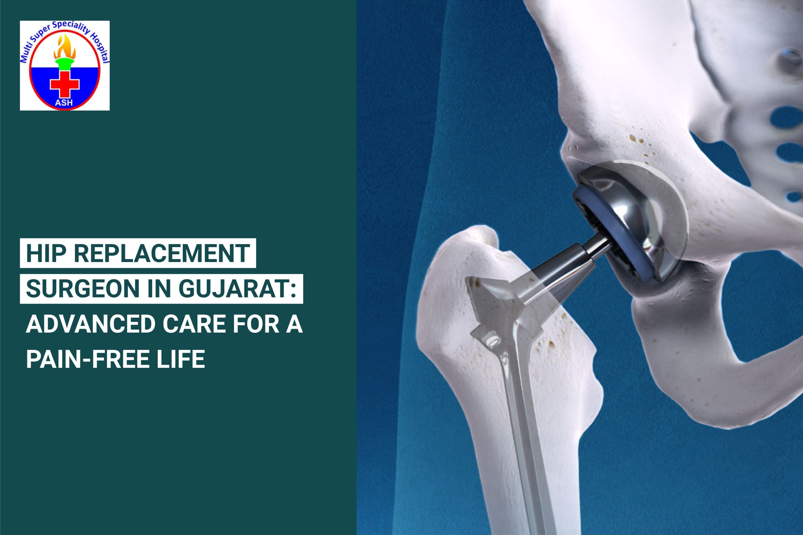 Hip Replacement Surgeon in Gujarat: Advanced Care for a Pain-Free Life