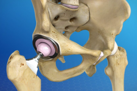Orthopaedic Care - Varunam Super Speciality Hospital