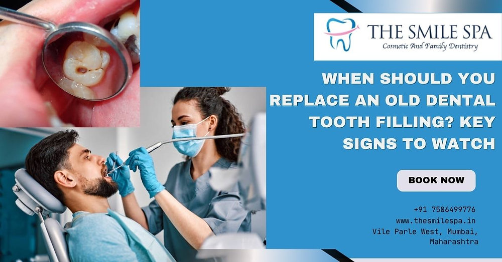 When Should You Replace an Old Dental Tooth Filling? Key Signs to Watch