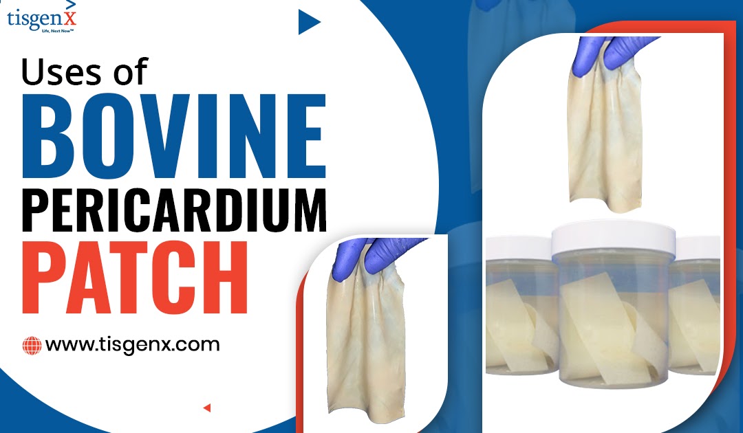 Uses of Bovine Pericardium Patch