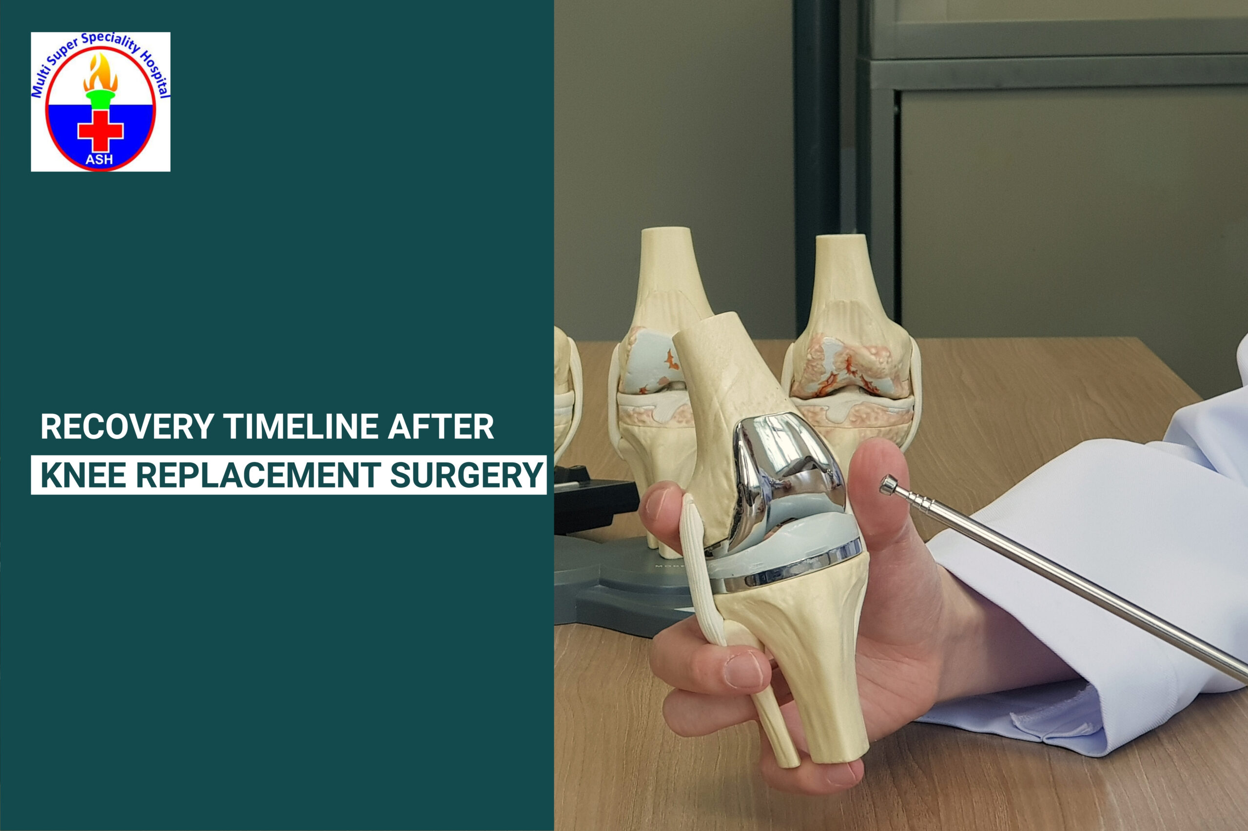 Recovery Timeline After Knee Replacement Surgery