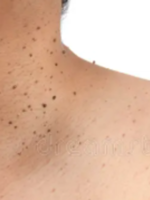 What to Expect Before a Skin Treatment in MK: Essential Tips for First-Timers | by Your Skin mk | Sep, 2025 | Medium