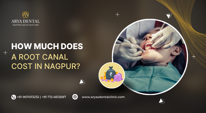 How much does a root canal cost in Nagpur?