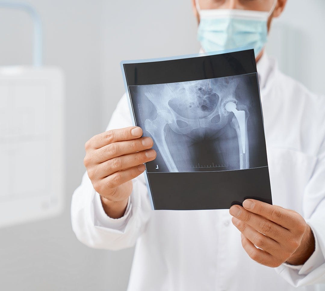 Calgary Hip and Knee Clinic Comprehensive Care and Advanced Treatments | by Timely Medical Alternatives | Sep, 2025 | Medium